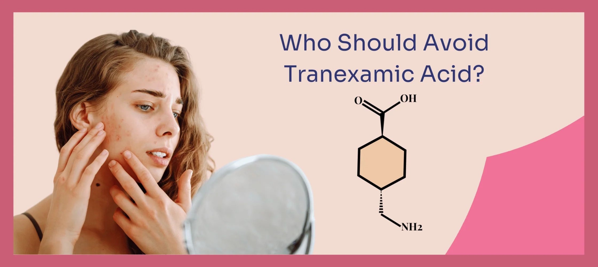 网红“氨甲环酸”被批准用于色斑治疗了吗？